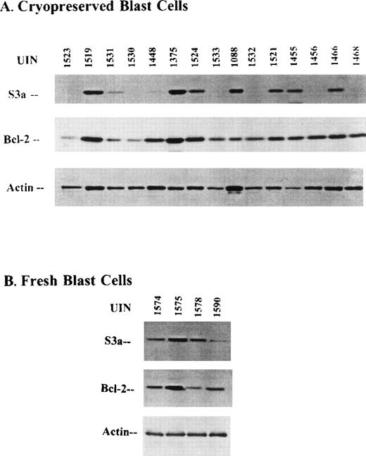 Fig. 8. Western blots of lysates stained for either bcl-2 or S3a. / (A) Cryopreserved blast cells. (B) Freshly obtained blasts.
