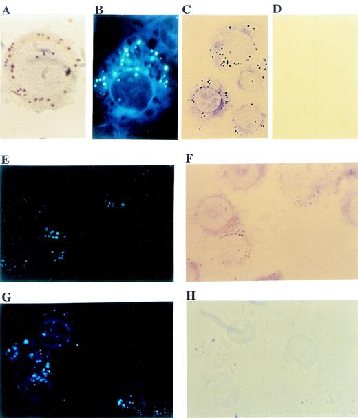 Fig. 1. Immunocytochemical localization of PI3K to cytoplasmic lipid bodies in U937 cells. / Cytoplasmic lipid bodies in U937 cells were stained with oil red O (A) or labeled with the fluorescent fatty acid, 1-pyrenedodecanoic acid (B). PI3K localization within cells was detected immunocytochemically with an mAb specific for the p85 isoforms of PI3K and avidin:biotinylated enzyme complex glucose oxidase immunocytochemistry, which yields colored reaction product at sites of p85 PI3K localization, including distinct punctate intracellular structures (C). In contrast, comparable immunocytochemistry with a control nonimmune mouse IgG yielded no staining (D). For dual labeling, U937 cells were labeled by incorporation of fluorescent fatty acid, 1-pyrenedodecanoic acid (E, G), and by immunocytochemistry with p85 mAb (F) or nonimmune mouse IgG (H). The punctate immunolocalization PI3K in (E) matched perfectly with fluorescent fatty acid–labeled lipid bodies (F). In contrast, although there were punctate fluorescent lipid bodies in control cells (G), no immunostaining was seen with nonimmune mouse IgG (H). It should be noted that fluorescent lipid body labelings in cells stained with PI3K (E) were weaker than in controls (G). This was likely due to quenching of fluorescence by the glucose oxidase product formed in the immunostaining (F) and the fact that larger lipid bodies in (H) were visualized as refractile, darker structures that lacked any specific glucose oxidase immunostaining. Objective magnification ×100 for (A) and (B) and × 63 for (C)-(H).