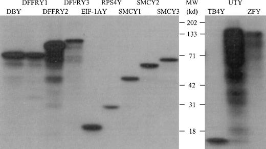 Fig. 1. In vitro transcription/translation of Y-specific cDNA. / The Y-specific genes were transcribed and translated using wheat germ extract and 3H-labeled leucine. The 3H-labeled proteins were separated on a 12% SDS-PAGE gel and were visualized by autoradiography.