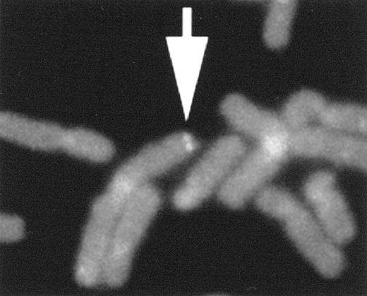 HHV-6 FISH on skin fibroblasts in metaphase. / Photograph shows representative FISH analysis with the probe pH6Z-101. Symmetrical doublet signals (arrow) are observed on both chromatids of chromosome 1 (1q44). The chromosomes were counterstained with propidium iodide.