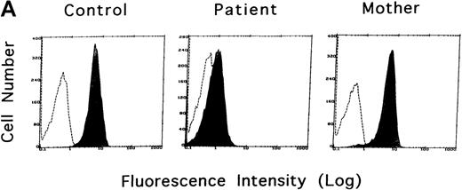 Fig. 1. WASP expression in 3 subjects. / (A) Flow cytometric analysis of WASP expression in normal individual (control), XLT patient (patient), and his mother (mother). The shaded areas and the dashed line indicate the staining with anti-WASP and control antibodies, respectively. (B) A Western blot analysis of WASP protein in the lysates from the 3 subjects above. WASP and β-actin protein as internal control were determined as approximately 59 kD and 42 kD proteins, respectively.