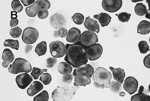 Fig. 2. Appearance of CD41brightc-kitbright cells. / (A) Cells sorted in the CD41bright c-kitbrightfraction were stained with Giemsa following cytocentrifugation. (B) CD41high c-kithigh cells after incubation with murine TPO (25 ng/mL) for 2 days. The magnification of the two images is similar (×1000).