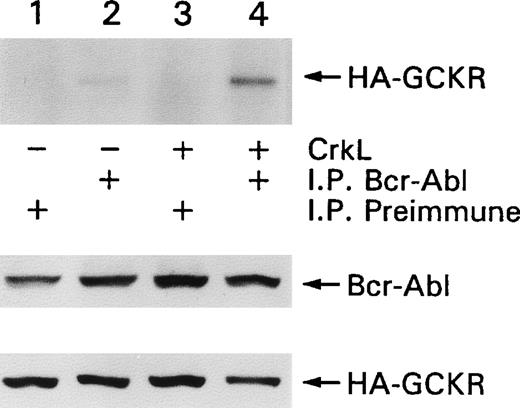 Fig. 4. CrkL enhances the association of Bcr-Abl and GCKR. / HEK 293T cells were transfected with constructs that directed the expression of Bcr-Abl and HA-GCKR in the presence or absence of CrkL (lanes 1, 2 versus lanes 3, 4). Bcr-Abl (lanes 2, 4) or control (lanes 1, 3) immunoprecipitates were analyzed by immunoblotting for HA-GCKR. Cell lysates from the same transfection were analyzed for Bcr-Abl and HA-GCKR by immunoblotting with a Bcr-Abl or an HA antibody. This experiment was preformed twice with similar results.