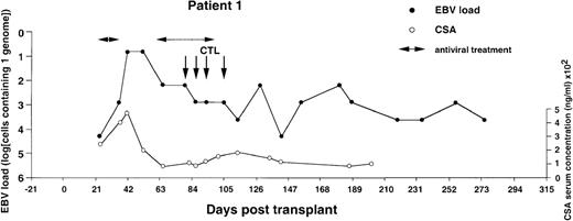 Fig. 1. Monitoring of EBV-DNA load and CsA levels in patient 1. / A 5-year-old boy with ALL received a TCD bone marrow graft from a mismatched unrelated donor. The posttransplant course was uncomplicated. A limited acute GVHD of the skin was treated with oral prednisolone. Four infusions of EBV-CTLs were given starting from day +79 after BMT without exacerbation of GVHD. Cyclosporin A was continued during follow-up.