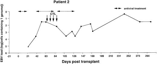 Fig. 2. Monitoring of EBV-DNA load in patient 2. / A 39-year-old woman with AML received a TCD bone marrow graft from a mismatched unrelated donor. Grade I GVHD developed after engraftment. Four CTL infusions were given starting from day +67. A booster of TCD marrow was given on day +134 because of threatening rejection. Cyclosporin A was continued during follow-up. *EBV-DNA was not detected in the DNA equivalent of 105 cells.