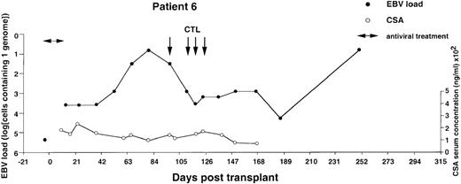 Fig. 5. Monitoring of EBV-DNA load and CsA levels in patient 6. / A 1-year-old boy with WAS received an unmanipulated bone marrow graft from an unrelated donor. The early posttransplant course was uncomplicated, with no GVHD. However, a mixed chimerism developed. Half of the B cells, granulocytes, and monocytes were of recipient origin, whereas T cells were exclusively of donor extraction. A moderate reticulocytopenia and mild hemolysis were treated with erythropoietin and steroids. Tapering of CsA was initiated but not completed during follow-up. Four EBV-CTL infusions were started on day +97. The EBV-DNA load determined before BMT is shown by an isolated filled circle.