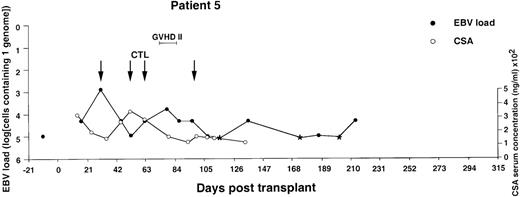 Fig. 6. Monitoring of EBV-DNA load and CsA levels in patient 5. / A 13-year-old boy with AML received a TCD bone marrow graft from a mismatched unrelated donor. Grade 2 GVHD was treated with oral prednisolone and psoralen plus ultraviolet A. Four infusions of EBV-CTLs were given prophylactically starting from day +31. The last injection was postponed for 2 weeks because of fever, mild exacerbation of GVHD, and pancytopenia. The EBV-DNA load determined before BMT is shown by an isolated filled circle. *EBV-DNA was not detected in the DNA equivalent of 105cells.