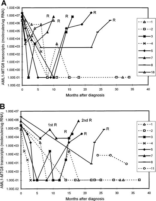 Fig. 1. Serial quantitation of AML1-MTG8 transcripts in 9 patients with t(8;21) acute myeloid leukemia (AML). / Results with bone marrow (BM) (A) and peripheral blood (PB) (B) samples are shown. Patients 3, 5, 7, 8, and 18 had a relapse (R), whereas patients 1, 2, 4, and 11 are in continuous remission. Levels of 1.00E-01 are reverse transcriptase-polymerase chain reaction (RT-PCR) negative.
