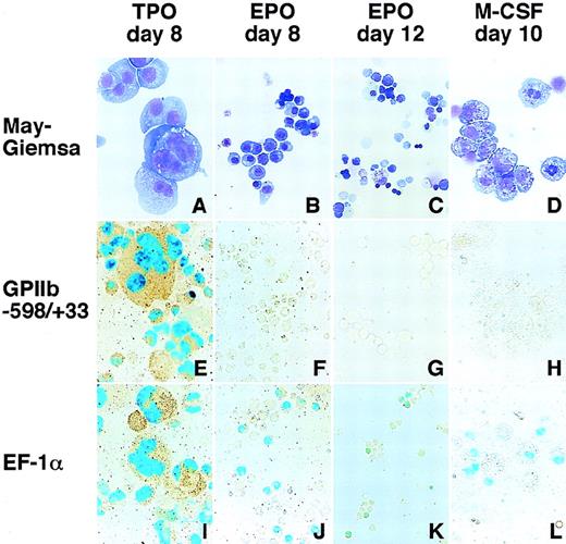 Fig. 1. Differentiation induction into megakaryocytes, erythroid cells, and macrophages and LacZ expression driven by the GPIIb promoter and EF1- promoter in these cells. / Hematopoietic cells were generated from ES cells by the addition of TPO (A, E, I), EPO (B, F, J for primitive embryonic erythrocytes and C, G, K for definitive adult erythrocytes), and M-CSF (D, H, L) for megakaryocytes, erythroid cells, and macrophages, respectively. May-Grunwald Giemsa staining was used to detect morphologic features (A-D). The LacZ gene driven by the GPIIb promoter from −598 to +33 (E-H) and the elongation factor-1α promoter (I-L) were transfected into ES cells with a plasmid carrying the neomycin-resistant gene. Differentiation induction was carried out after G418 selection, and the cells were stained with X-gal. Double staining with AChE was performed to confirm LacZ expression in megakaryocytes.