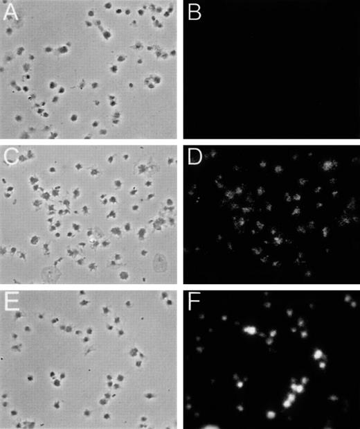 Fig. 3. Immunostaining of platelets with MARCKS and CD41a antibodies. / Intact platelets were fixed, permeabilized, and immunostained with either human MARCKS mouse monoclonal antibody (C and D) or human CD41a (fibrinogen receptor) mouse monoclonal antibody (E and F). The second antibody used in both cases was affinity-purifed Cy3-conjugated donkey Fab2 fragment raised against mouse IgG (dilution 1:200). Panels A and B show control platelets incubated only with the second antibody.