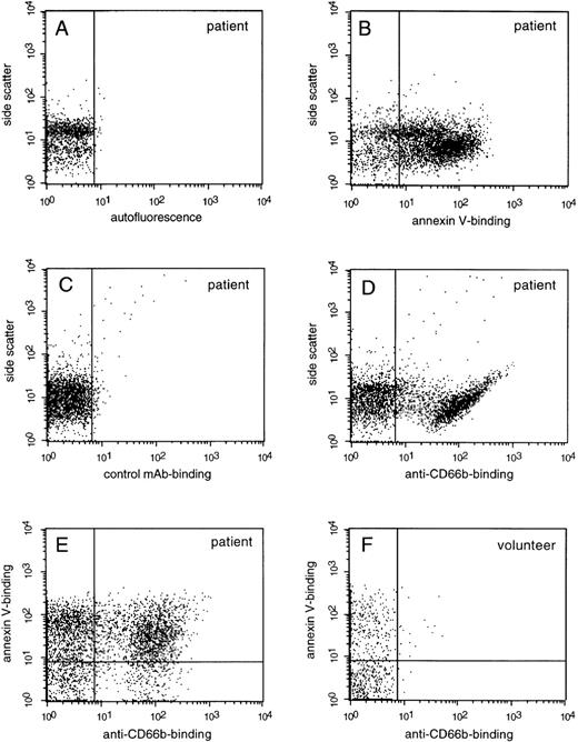 Fig. 1. Representative fluorescence-activated cell sorter (FACS) dot plots of granulocyte-derived microparticles in plasma from a patient who survived meningococcal sepsis. / Microparticles were isolated from the plasma of a (surviving) patient on admission, labeled, and analyzed by flow cytometry as described in “Materials and Methods.” (A) Unlabeled microparticles (autofluorescence); (B) labeled with annexin V–PE; (C) labeled with IgG1-FITC (control mAb); (D) labeled with anti-CD66b–FITC; and (E) double staining with annexin V–PE and anti-CD66b–FITC. (F) Representative dot plot of microparticles isolated from healthy volunteer plasma, double stained with annexin V–PE and anti-CD66b–FITC, for comparison.