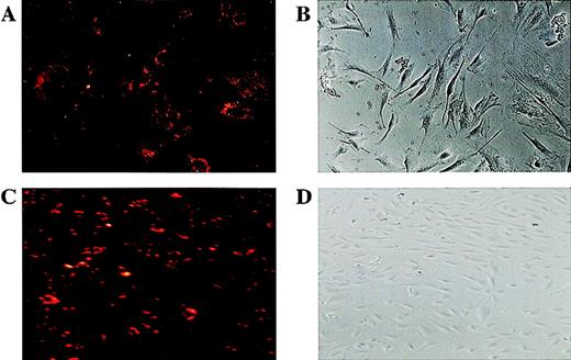 Fig. 5. Plating efficiency of CD34+ cells to form endothelial cell colonies. / A highly pure population of CD34+ cells was isolated from human FL cells and maintained in VEGF (10 ng/mL) and FGF-2 (2 ng/mL). VEGFR-2+ cells were isolated using Biotin-labeled anti-VEGFR-2 MoAb and Streptavidin Dynal magnetic beads. Isolated cells were incubated in EC-specific media (containing FGF-2+ and VEGF) in limiting dilutions approximating 1 single cell per well, and after 10-14 days endothelial colonies were quantified using Dil-Ac-LDL labeling. Typical Dil-Ac-LDL± endothelial cells (A) within an adherent endothelial colony (A,B; phase contrast microscopy 350 × ) are shown. Maintaining of the endothelial colonies in the FGF-2 and VEGF resulted in the proliferation of characteristic endothelial cobblestone colonies (D), where most of cells were Dil-Ac-LDL+ (C,D; 200 × ).