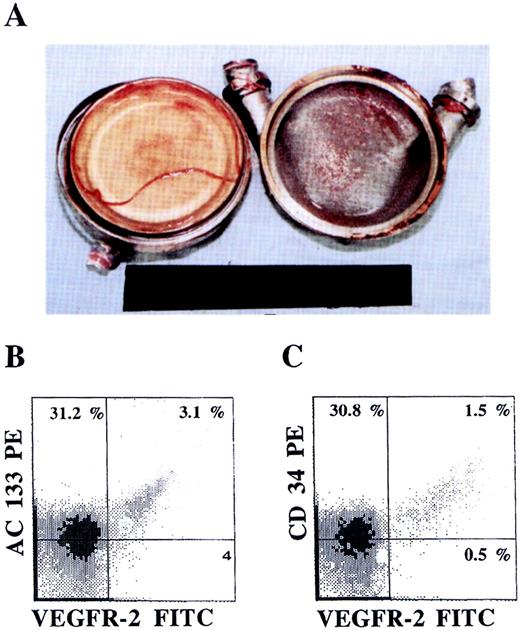 Fig. 6. Colonization of LVADs with AC133+VEGFR-2+ cells. / An LVAD opened after explantation (A) 28 days after placement revealed formation of neo-intima on both the sintered titanium housing (right) and the polyurethane diaphragm (left) surfaces. The phenotype of the mononuclear cells derived from the neo-intima formed, analyzed by dual-color flow cytometry, demonstrated the presence of AC133+VEGFR+ (B) as well as CD34+VEGFR-2+ (C) endothelial precursor cells.