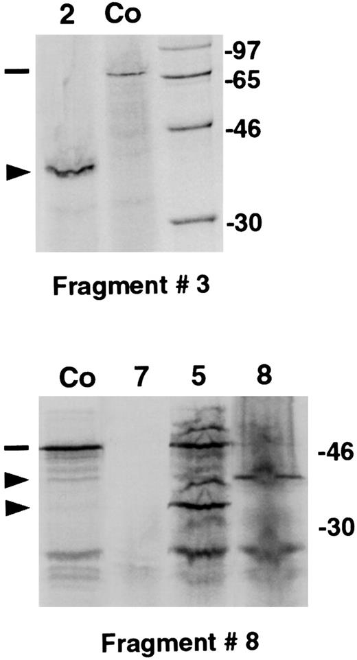 Fig. 1. Mutation screening by protein truncation test. / PTT analysis shows abnormal fragment 3 pattern in patient 2 and abnormal fragment 8 pattern in patients 5, 7, and 8 in comparison with the control (Co). (dashes) Wild-type, full-length products. (arrows) Abnormal bands. Nonspecific additional bands can be seen in some samples. Marker and molecular weights of the marker proteins (in kd) are shown on the right-hand side of the gels.