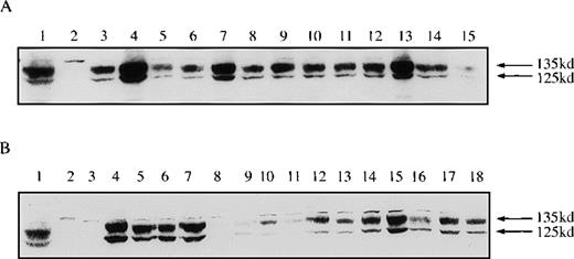 Fig. 1. Expression of fibroblast growth factor receptor 3 (FGFR3) is achieved at variable levels in B9-WT and B9-TD cells. / (A) Western blot analysis, probing with anti-FGFR3, shows the expression of FGFR3 in B9 clones: KMS11 myeloma cell line positive control for FGFR3 (lane 1), parental B9 (lane 2), and B9-WT subclones (lanes 3-15). Lane 4 (clone #3) and lane 7 (clone #6) represent clones selected for further study. (B) KMS11 positive control for FGFR3 (lane 1), U266 myeloma cell line negative control (lane 2), parental B9 (lane 3), and B9-TD subclones (lanes 4-18). Lane 17 represents clone #14 selected for further study.