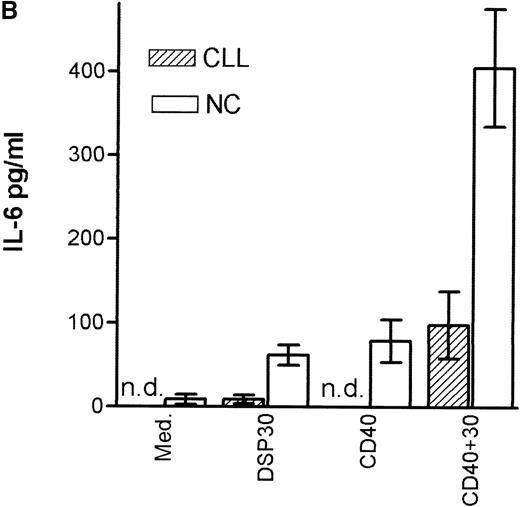 Fig. 4. Cytokine production of chronic lymphocytic leukemia (CLL) B cells and normal B cells in response to DSP30 with or without costimulation with CD40LF cells. / Purified B-CLL cells and B cells from normal control subjects were stimulated with DSP30 at 2 μmol/L with or without 1 × 105 CD40LF. Supernatants were tested for tumor necrosis factor α (A) or interleuken-6 (B) with the use of an enzyme-linked immunosorbent assay system. Results are expressed as mean ± SEM of 11 patients with B-CLL and 7 normal control subjects; n.d. means not detectable.