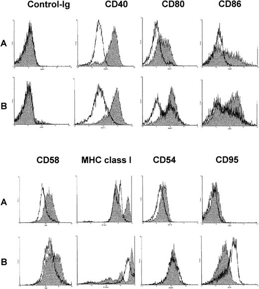 Fig. 5. Change of surface antigen phenotype of chronic lymphocytic leukemia (CLL) B cells stimulated with DSP30, CD40LF, or both. / 106 B cells were cultured for 48 hours in medium alone (A, unshaded histograms), with DSP30 at 2 μmol/L (A, shaded histograms), with 105 CD40LF (B, unshaded histograms), or with DSP30 and CD40LF (B, shaded histograms).