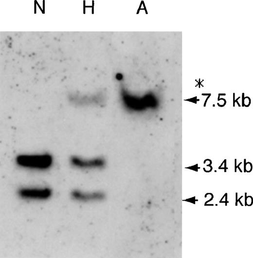 Fig. 1. Southern blot analysis of genomic DNA using theHp β cDNA probe. / Genomic DNAs (7 μg) from a patient (NK) with anhaptoglobinemia (lane A), from an individual with hypohaptoglobinemia (lane H) and from a control individual (lane N) were digested by SacI. The band indicated by an asterisk was unexpected. The sizes (kb) of the hybridized fragments are indicated.
