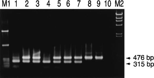 Fig. 5. Family study of the Hpdel allele in 2 families of anhaptoglobinemic patients with anti-haptoglobin antibody. / Simultaneous PCR amplification of the junction region of theHpdel allele and of exon 1 of theHp was carried out. PCR products underwent electrophoresis in a 1.2% agarose gel and were stained by ethidium bromide. Lanes 1, 2, and 3 are SN and 2 children of SN. Lanes 4, 5, 6, and 7 are NK, father, mother, and brother of NK. Lanes 8 and 9 are control individuals. Lane 10 is negative control. The size of the PCR product is indicated.TaqI-digested φ × 174 (M1) andHindIII-digested λ phage (M2) were used as molecular size markers.