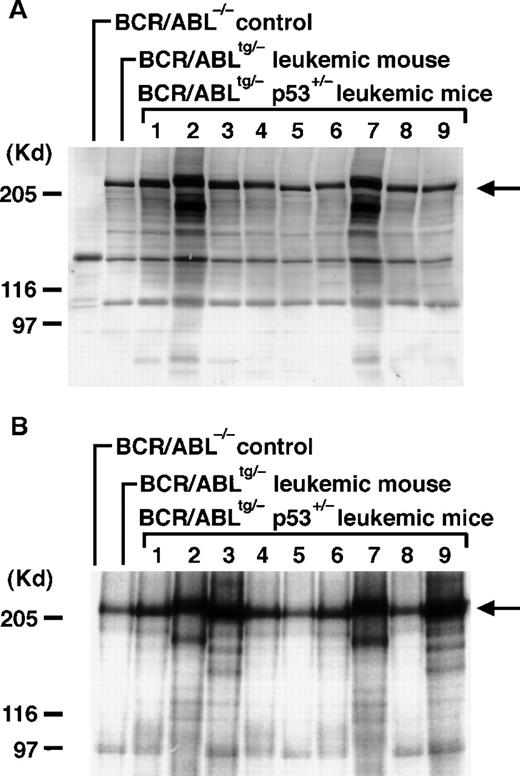 Fig. 3. Expression, kinase activity, and TCR rearrangements in p210bcr/abl in the leukemic tissues ofBCR/ABLtg/−p53+/− mice. / For the expression assessment (A), 50 μg of protein aliquots extracted from the enlarged thymus or pleural effusion of 9BCR/ABLtg/−p53+/−leukemic mice (no. 1-9 on Table 1) was separated by 6% sodium dodecyl sulfate-polyacrylamide gel electrophoresis (SDS-PAGE), transferred to a nitrocellulose membrane, and probed with the anti-Abl monoclonal antibody AB3 (1:500). To determine kinase activity (B), 1 mg of protein aliquot extracted from the same tissues shown in Figure 3A was incubated with AB3 (1:200) and the immunoprecipitated proteins were subjected to in vitro kinase assays. Phosphorylated proteins were separated by 6% SDS-PAGE, dried, and autoradiographed. For both the expression and kinase activity assessments, the thymus of a normalBCR/ABL−/− control mouse was the negative control, and the thymus of aBCR/ABLtg/− leukemic mouse21was the positive control. The arrow indicates the position of p210bcr/abl; the positions of the molecular markers are shown on the left. To describe TCR rearrangements (C), 5 μg of DNAs digested with EcoRI was separated by 0.7% agarose gel, blotted to a nylon membrane, and probed with a phosphorus 32-dCTP–labeled TCRγ probe. DNA extracted from normal thymus tissue was used as a control (denoted by C). Molecular markers are shown on the left.