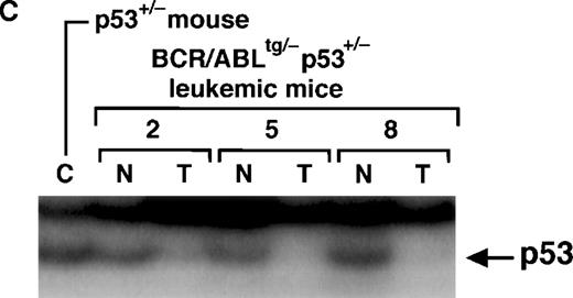 Fig. 4. Polymerase chain reaction–single-strand conformation polymorphism (PCR-SSCP) analysis of the p53 gene and expression of p53 protein in the leukemic tissues ofBCR/ABLtg/−p53+/− mice. / (A) Schematic model of the region of the mouse p53 gene that showed a polymorphic pattern between the p53 wild-type allele and the p53 null allele. The nucleotide sequences and amino acids of the wild-type allele and the null allele, which showed a polymorphism, are also shown. The box denotes exon 5; black bars, adjacent introns; white triangles, locations of the primers used for amplification (p5-1 and p5-2); and the diamond, the polymorphic site. (B) Results of PCR-SSCP. DNAs extracted from the tumor tissues (T) of 9BCR/ABLtg/−p53+/−leukemic mice (no. 1-9) were subjected to PCR-SSCP analysis. In mice 2, 5, and 8, DNAs extracted from the normal tissues (N) were also analyzed to provide an internal control. DNAs extracted from the normal tissues of a p53+/− mouse and aBCR/ABLtg/− mouse were used as controls for detecting the migration patterns of the parental alleles. Black triangles denote the position of allele A (null); and white triangles, the position of allele B (wild-type). (C) Absence of p53 protein. Proteins extracted from tumor tissues (T) and normal tissues (N) of mice 2, 5, and 8 were subjected to immunoprecipitation/Western blot analysis using anti-p53 antibodies. Normal tissue from a p53+/− mouse was used as a control (denoted by C). The arrow indicates the position of p53.
