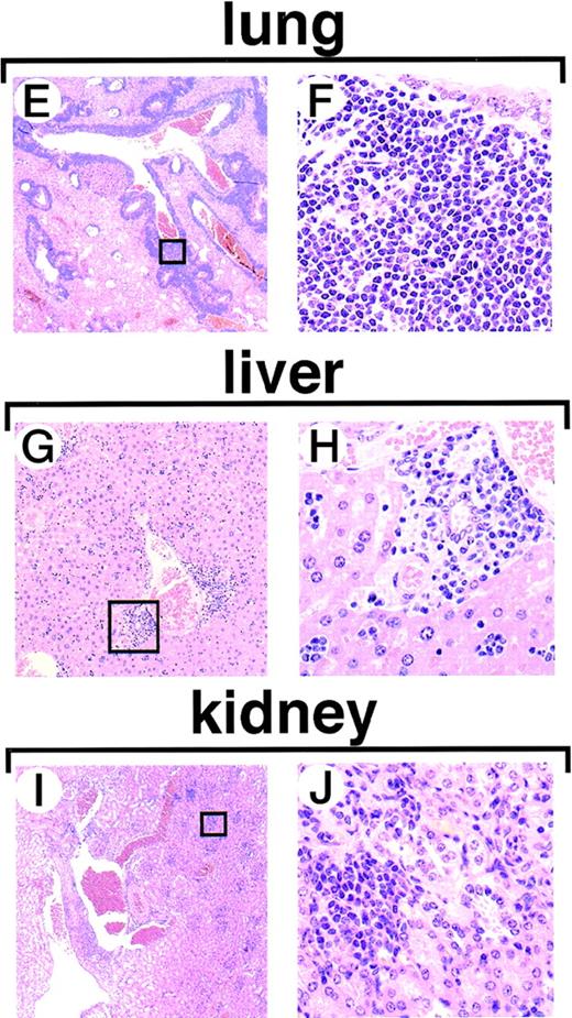 Fig. 2. Pathological analysis ofBCR/ABLtg/−p53+/− leukemic mice. / Figures 2A to 2D show Wright-Giemsa staining of stamped or smeared specimens of hematopoietic tissues. Massive proliferation of lymphoblasts is observed in the thymus (A) and in the pleural effusion (B). In mice with late onset of acute transformation, proliferation of granulocytes is evident in the peripheral blood (C) and the bone marrow shows marked hyperplasia of myeloid cells (D). Figures 2E to 2J show hematoxylin-eosin staining of tissue from the following: the lung (2E and 2F), liver (2G and 2H), and kidney (2I and 2J). Infiltration of leukemic cells was detected around the blood vessels. The boxed areas in Figures 2E, 2G, and 2I are magnified in Figures 2F, 2H, and 2J, respectively.
