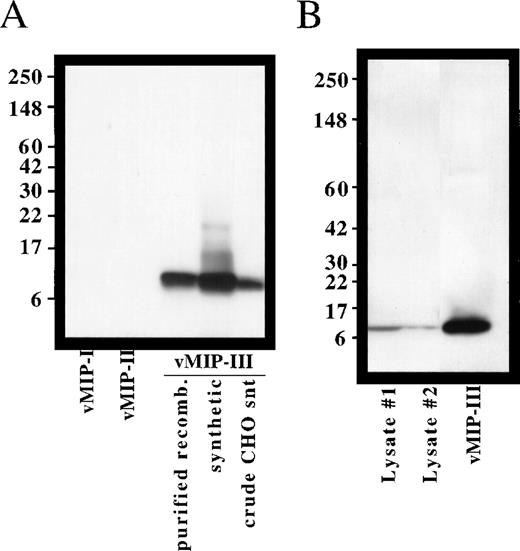 Fig. 2. Specificity of vMIP-III antibodies and expression of vMIP-III in KS lesions. / (A) Polyclonal antibodies were generated in rabbits and examined for their ability to recognize synthetic or mammalian cell-derived vMIP-III by Western blotting. With the exception of the crude supernatant, 100 ng each sample was loaded. Synthetic vMIP-I and vMIP-II served as negative controls. (B) Expression of vMIP-III in lesions from advanced-stage KS was determined by Western blotting. Blots probed with preimmune sera did not detect these bands.