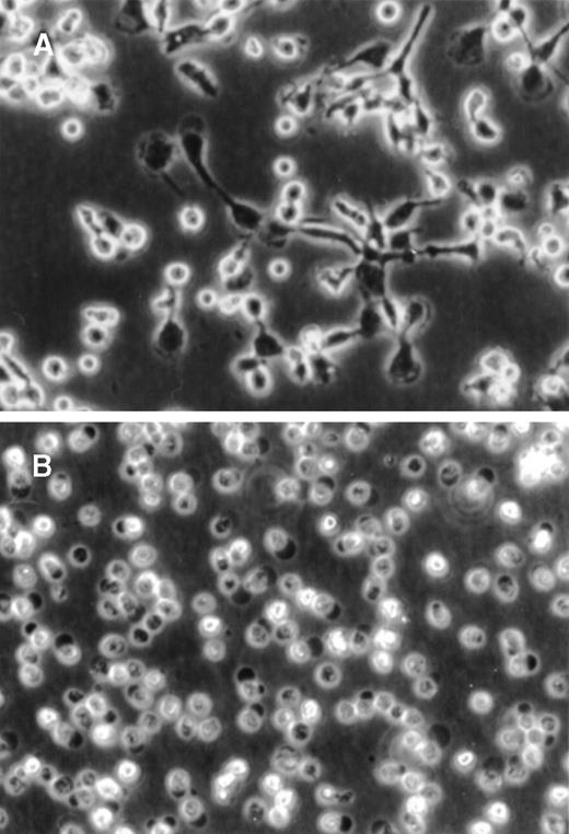 Fig. 1. PF4-induced changes in monocyte morphology. / Purified human monocytes were (A) cultured for 72 hours in the presence of 4 μmol/L PF4 or (B) left untreated. Photographs were taken by phase-contrast microscopy at the same magnification (× 20).