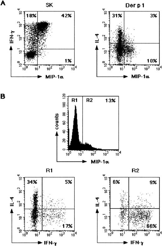 Fig. 6. Intracellular detection of MIP-1 production by IFN-γ– producing Ag-specific CD4+ T cells but not by IL-4–producing antigen-specific CD4+ T cells. / (A) T-cell blasts from SK-specific or Der p 1–specific short-term T cell lines were stimulated with PMA plus ionomycin on day 6 after infection with HIV-1BaL strain and simultaneously analyzed for MIP-1αb IFN-γ, and IL-4 content, as described in “Materials and Methods.” (B) IL-4 and IFN-γ production in MIP-1α–negative (R1) and MIP-1α–positive (R2) Der p 1–specific CD4+ T cells shown in (A). The area of MIP-1α positivity was determined against an isotype-matched antibody.