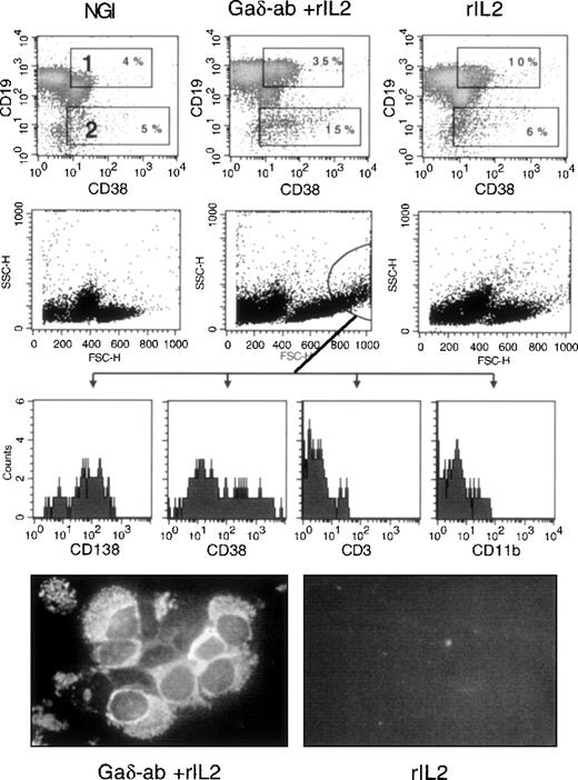 Fig. 6. Differentiation into plasma cells of CD38-positive B-CLL cells after treatment with Gaδ-ab and rIL2. / CD38-positive B-CLL cells were cultured in the presence of NGI, Gaδ-ab (10 μg/mL) plus rIL2 (100 U/mL), or rIL2 alone for 5 days. Cells were recovered, stained, and analyzed by flow cytometry. (top) Double staining for CD19 and CD38 of the cells cultured with the indicated stimuli. Gates 1 and 2 show CD19-bright, CD38-bright, and CD19-dim/CD38-bright cells, respectively, together with their percentages. (middle) FSC and SSC parameters of the cultured cells. Large cells with substantial cytoplasmic granularity were gated, and their fluorescence relative to the CD138, CD38, CD3, and CD11b stainings was recorded (bottom histograms). These cells were present only in Gaδ-ab-stimulated cultures. Cytospin preparations from Gaδ-ab rIL2–cultured cells (left) or rIL2 cultured cells (right) were fixed and stained with FITC-conjugated anti-IgM mAb. Results are from 1 representative experiment (patient B) of the 3 performed (patients B, E, F).