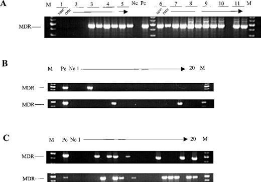 Fig. 4. Detection of SF-MDR provirus in cells obtained from chimeric NOD/SCID mice. / (A) PCR analysis of the mononuclear cell (MNC) fraction and the granulocyte (polymorphonuclear; PMN) fractions of BM recovered from 11 mice (NOD/SCID set 7) engrafted with mock-transduced (1 and 2) orMDR1-transduced (3-11) CD34+ PBPC. (B) Detection of the SF-MDR proviral genome in individual colonies derived from 2 chimeric mice (NOD/SCID sets 2 and 8) engrafted with Transwell-transduced CD34+ PBPC. (C) Detection of the SF-MDR proviral genome in individual colonies derived from 2 chimeric mice (NOD/SCID set 10) engrafted with supernatant-transduced CD34+ PBPC. M denotes molecular-weight size marker; Nc, no-template PCR control; and Pc, SF-MDR producer cells diluted 10−5-fold in provirus-negative HL-60 cells.
