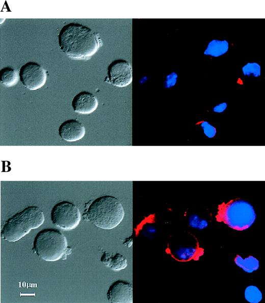 Fig. 1. TAMRA-labeled (ODN) uptake in D10 cells. / Phase-contrast (left panel) and fluorescence (right panel) confocal photomicrographs of D10 cells that were transfected with TAMRA-labeled double-stranded ODN (2 μmol/L) for 6 hours with the use of cationic liposomes. Cells were then stimulated without (A) or with (B) 100 nmol/L IL-4 at 37°C for 10 minutes. Cells were fixed with 5% paraformaldehyde and co-loaded with DAPI and examined by laser scanning confocal microscope.