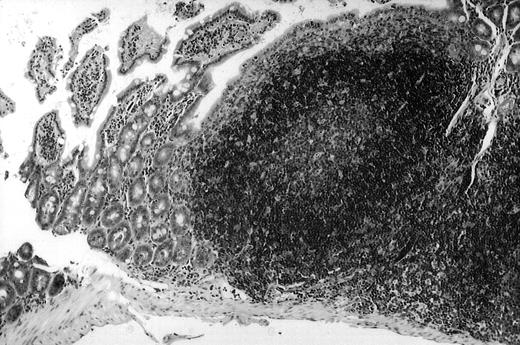 Fig. 1. Presence of transduced human CD40L protein in mice treated with ST40L. / (A) HE staining of intestine ( × 100) of BALB/c mice killed 1 week after oral administration of ST40L. (B) Immunostaining of Peyer's patches using antihuman CD40L Ab (×400) of BALB/c mice killed 1 week after oral administration of ST40L. (C) Immunostaining of Peyer's patches using antihuman CD40L Ab (×400) of BALB/c mice killed 1 week after oral administration of ST.
