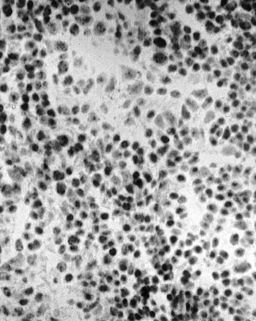 Fig. 1. Presence of transduced human CD40L protein in mice treated with ST40L. / (A) HE staining of intestine ( × 100) of BALB/c mice killed 1 week after oral administration of ST40L. (B) Immunostaining of Peyer's patches using antihuman CD40L Ab (×400) of BALB/c mice killed 1 week after oral administration of ST40L. (C) Immunostaining of Peyer's patches using antihuman CD40L Ab (×400) of BALB/c mice killed 1 week after oral administration of ST.
