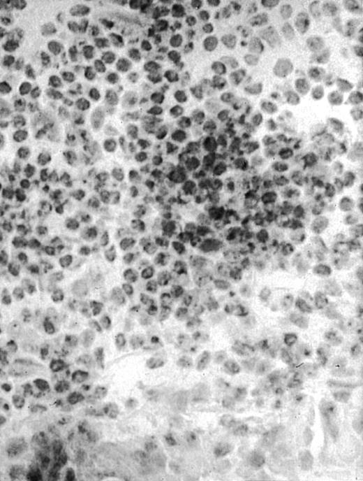 Fig. 1. Presence of transduced human CD40L protein in mice treated with ST40L. / (A) HE staining of intestine ( × 100) of BALB/c mice killed 1 week after oral administration of ST40L. (B) Immunostaining of Peyer's patches using antihuman CD40L Ab (×400) of BALB/c mice killed 1 week after oral administration of ST40L. (C) Immunostaining of Peyer's patches using antihuman CD40L Ab (×400) of BALB/c mice killed 1 week after oral administration of ST.