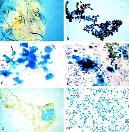 Fig. 2. LacZ activation as revealed by histochemical X-gal staining. / (A) Whole embryo staining by X-gal. Yolk sac blood vessels were intensely stained. (B) Embryonic blood stained for X-gal showing that white cells (shown by arrows) are negative. (C, D) Plasma clots stained for benzidine, X-gal, and counterstained with hematoxylin. (C) One megakaryocytic colony is shown. Also present is a group of 3 benzidine-positive and X-gal-positive erythroid cells (arrows) and scattered white cells negative for X-gal. (D) Two megakaryocytic (m) colonies and 1 erythroid (e) colony (right upper corner) are seen, along with scattered white cells. Note the presence of positive and negative X-gal erythroid cells (arrows). (E) Spleen section with an X-gal-positive colony (CFU-S). (F) Red cells from a SCID/NOD mouse transplanted with FDG(+)/TER119(−) fetal liver cells at 5 weeks after transplantation. Note the larger size of X-gal(+) fetal red cells.