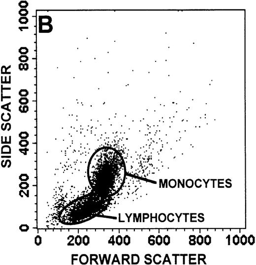 Fig. 1. Identification of lymphocyte and monocyte subpopulations in cells isolated from WAS and control blood immediately and 24 hours after venipuncture. / (A, C, E) Identification of unlabeled, FITC-anti-CD3–labeled, and PE-anti-CD14–labeled populations in cells isolated from WAS patient blood immediately (A) and 24 hours (C) after venipuncture and in cells isolated from control blood 24 hours (E) after venipuncture. Four different subpopulations were identified in these cells: T lymphocytes (CD3+/CD14-), monocytes (CD14+/CD3-), unlabeled (UN), and necrotic lymphocytes (CD3+/CD14-(N)-seen only in panel C). These graphs are representative of data collected from 2 patients with WAS and at least 5 control donors. (B, D, F) Dot plots showing forward and side-scatter data for cells isolated from WAS patient blood immediately (B) and 24 hours (D) after venipuncture and in cells isolated from control blood 24 hours (F) after venipuncture. Three different subpopulations were identified in these cells: lymphocytes, necrotic lymphocytes (only in C), and monocytes. These graphs are representative of data collected from 2 patients with WAS and at least 5 control donors.