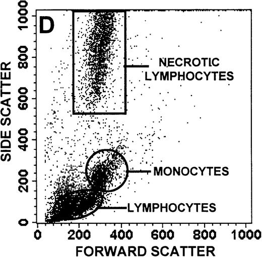 Fig. 1. Identification of lymphocyte and monocyte subpopulations in cells isolated from WAS and control blood immediately and 24 hours after venipuncture. / (A, C, E) Identification of unlabeled, FITC-anti-CD3–labeled, and PE-anti-CD14–labeled populations in cells isolated from WAS patient blood immediately (A) and 24 hours (C) after venipuncture and in cells isolated from control blood 24 hours (E) after venipuncture. Four different subpopulations were identified in these cells: T lymphocytes (CD3+/CD14-), monocytes (CD14+/CD3-), unlabeled (UN), and necrotic lymphocytes (CD3+/CD14-(N)-seen only in panel C). These graphs are representative of data collected from 2 patients with WAS and at least 5 control donors. (B, D, F) Dot plots showing forward and side-scatter data for cells isolated from WAS patient blood immediately (B) and 24 hours (D) after venipuncture and in cells isolated from control blood 24 hours (F) after venipuncture. Three different subpopulations were identified in these cells: lymphocytes, necrotic lymphocytes (only in C), and monocytes. These graphs are representative of data collected from 2 patients with WAS and at least 5 control donors.