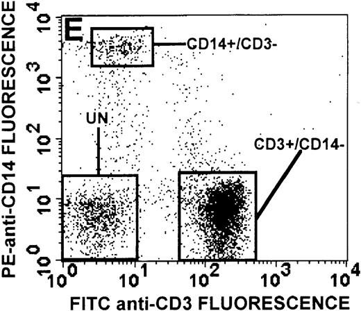 Fig. 1. Identification of lymphocyte and monocyte subpopulations in cells isolated from WAS and control blood immediately and 24 hours after venipuncture. / (A, C, E) Identification of unlabeled, FITC-anti-CD3–labeled, and PE-anti-CD14–labeled populations in cells isolated from WAS patient blood immediately (A) and 24 hours (C) after venipuncture and in cells isolated from control blood 24 hours (E) after venipuncture. Four different subpopulations were identified in these cells: T lymphocytes (CD3+/CD14-), monocytes (CD14+/CD3-), unlabeled (UN), and necrotic lymphocytes (CD3+/CD14-(N)-seen only in panel C). These graphs are representative of data collected from 2 patients with WAS and at least 5 control donors. (B, D, F) Dot plots showing forward and side-scatter data for cells isolated from WAS patient blood immediately (B) and 24 hours (D) after venipuncture and in cells isolated from control blood 24 hours (F) after venipuncture. Three different subpopulations were identified in these cells: lymphocytes, necrotic lymphocytes (only in C), and monocytes. These graphs are representative of data collected from 2 patients with WAS and at least 5 control donors.