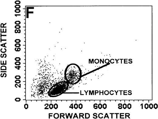 Fig. 1. Identification of lymphocyte and monocyte subpopulations in cells isolated from WAS and control blood immediately and 24 hours after venipuncture. / (A, C, E) Identification of unlabeled, FITC-anti-CD3–labeled, and PE-anti-CD14–labeled populations in cells isolated from WAS patient blood immediately (A) and 24 hours (C) after venipuncture and in cells isolated from control blood 24 hours (E) after venipuncture. Four different subpopulations were identified in these cells: T lymphocytes (CD3+/CD14-), monocytes (CD14+/CD3-), unlabeled (UN), and necrotic lymphocytes (CD3+/CD14-(N)-seen only in panel C). These graphs are representative of data collected from 2 patients with WAS and at least 5 control donors. (B, D, F) Dot plots showing forward and side-scatter data for cells isolated from WAS patient blood immediately (B) and 24 hours (D) after venipuncture and in cells isolated from control blood 24 hours (F) after venipuncture. Three different subpopulations were identified in these cells: lymphocytes, necrotic lymphocytes (only in C), and monocytes. These graphs are representative of data collected from 2 patients with WAS and at least 5 control donors.