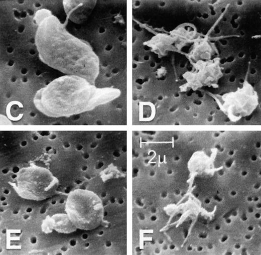 Fig. 2. Actin polymerization in platelets from patients with WAS and XLT and from controls. / (A, B) Platelets isolated from whole blood and maintained at 37°C in autologous platelet-rich plasma were stimulated with either PGF2α, ADP, or buffer (▪)at the indicated concentrations.21 Data reflect the typical responses from each patient group and the control group. Error bars represent the SEM for duplicate simultaneous determinations for a single donor (control, WAS, or XLT). These graphs are representative of data collected from 2 patients with WAS (○), 2 patients with XLT (⧫), and 5 control donors (▴). (C-F) Representative scanning electron micrographs of platelets fixed before (C, E) and 180 seconds after stimulation (D, F) with 1 μmol/L PGF2α from a patient with classic WAS (E, F) and control (C, D). Images are 8-μm fields, and samples were prepared as previously described.28 Platelets isolated from patients with WAS were consistently smaller, as previously reported.2 Images are representative of data collected from 2 patients with WAS and 3 control donors.