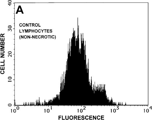 Fig. 8. Caspase-3 activity and actin polymerization response in zVAD-fmk-treated and untreated WAS lymphocytes isolated 24 hours after venipuncture. / (A, B) Activity of caspase-3 in lymphocytes isolated from whole blood that had been incubated at room temperature for 24 hours. Data are expressed as a histogram with fluorescence intensity on the x-axis and cell number on the y-axis. Mean fluorescence intensities of the control and patient lymphocyte populations were 116 and 290, respectively. Graphs are representative of data collected from a single WAS patient and a control. (C, D) Caspase-3 activity in lymphocytes isolated from whole blood (from a single patient with WAS) that had been treated for 24 hours with and without 50 μmol/L zVAD-fmk. (C) Caspase-3 activity in untreated lymphocytes. (D) Caspase-3 activity in treated cells. Note the marked decrease in fluorescence in the treated lymphocytes. Mean fluorescence intensities in untreated and zVAD-fmk–treated WAS lymphocytes were 403 and 223, respectively. Because the instrumental settings of the flow cytometer varied from day to day, these data cannot be compared directly with those shown in A and B. (E) Percentages of viable, apoptotic, and necrotic lymphocytes from WAS lymphocytes isolated from 24-hour-old blood incubated with and without 50 μmol/L zVAD-fmk as defined previously. Graphs are representative of data taken from a single WAS patient and a single control. (F) Actin polymerization response in WAS lymphocytes isolated from 24-hour-old blood incubated with and without 50 μmol/L zVAD-fmk. The actin polymerization response of WAS lymphocytes was stimulated with 100 nmol/L PMA for 40 minutes at 37°C. Error bars represent SEM of duplicate determinations from a single donor (WAS). This graph is representative of data collected from a single patient with WAS.
