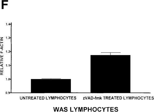 Fig. 8. Caspase-3 activity and actin polymerization response in zVAD-fmk-treated and untreated WAS lymphocytes isolated 24 hours after venipuncture. / (A, B) Activity of caspase-3 in lymphocytes isolated from whole blood that had been incubated at room temperature for 24 hours. Data are expressed as a histogram with fluorescence intensity on the x-axis and cell number on the y-axis. Mean fluorescence intensities of the control and patient lymphocyte populations were 116 and 290, respectively. Graphs are representative of data collected from a single WAS patient and a control. (C, D) Caspase-3 activity in lymphocytes isolated from whole blood (from a single patient with WAS) that had been treated for 24 hours with and without 50 μmol/L zVAD-fmk. (C) Caspase-3 activity in untreated lymphocytes. (D) Caspase-3 activity in treated cells. Note the marked decrease in fluorescence in the treated lymphocytes. Mean fluorescence intensities in untreated and zVAD-fmk–treated WAS lymphocytes were 403 and 223, respectively. Because the instrumental settings of the flow cytometer varied from day to day, these data cannot be compared directly with those shown in A and B. (E) Percentages of viable, apoptotic, and necrotic lymphocytes from WAS lymphocytes isolated from 24-hour-old blood incubated with and without 50 μmol/L zVAD-fmk as defined previously. Graphs are representative of data taken from a single WAS patient and a single control. (F) Actin polymerization response in WAS lymphocytes isolated from 24-hour-old blood incubated with and without 50 μmol/L zVAD-fmk. The actin polymerization response of WAS lymphocytes was stimulated with 100 nmol/L PMA for 40 minutes at 37°C. Error bars represent SEM of duplicate determinations from a single donor (WAS). This graph is representative of data collected from a single patient with WAS.