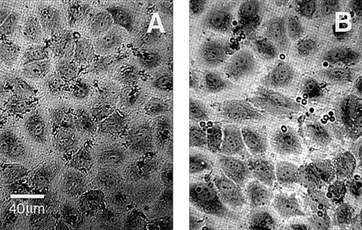 Fig. 2. HUVEC monolayers incubated with normal or PS-exposing RBCs. / (A) Normal RBCs. (B) PS-exposing RBCs. EC retraction was caused by an incubation with an RBC population containing 40% PS-exposing cells. Images were obtained at a magnification ×400; the final scale is indicated.