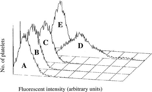 Fig. 3. Platelet-associated human IgG during Sk-induced platelet aggregation. / Following agonist treatment, platelets were incubated with an FITC-labeled antibody against human IgG and platelet-associated fluorescence measured using flow cytometry. (A) Platelets stirred in the absence of agonist. (B) Subthreshold concentration of ADP. (C) 500 U/mL Sk alone. (D) ADP in the presence of 500 U/mL Sk. (E) Treated with the Fc receptor-blocking antibody IV.3 prior to the addition of Sk and ADP.