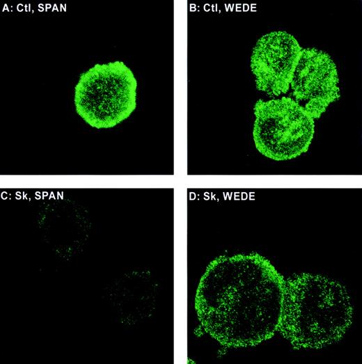 Fig. 6. Fluorescent microscopy of PAR-1 on HEL cells. / Cells were stained with the cleavage-sensitive PAR-1 antibody SPAN 12 (A and C) or the cleavage-insensitive PAR-1 antibody WEDE 15 (B and D) and treated with no agonist (A and B) or Sk (C and D) in plasma from an individual whose platelets aggregated to Sk.