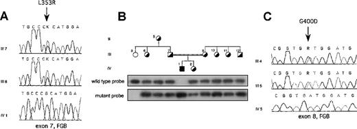Fig. 2. L353R and G400D mutations. / (A) Electropherograms showing the mutation identified in the Italian proband with afibrinogenemia. The T-G transversion leading to the L353R mutation, indicated by an arrow, was present in the heterozygous state in both parents. (B) ASO hybridization showing cosegregation of the L353R mutation and clinical phenotype in the Italian kindred. Family members were phenotypically classified as homozygous normal or heterozygote on the basis of plasma fibrinogen levels. Individuals within the pedigree are positioned above the corresponding lanes. Wild-type (FGB-L353) and mutant (FGB-R353) probes are listed in Table1. (C) Electropherograms showing the mutation identified in the Iranian proband with afibrinogenemia. The G-A transition leading to the G400D mutation, indicated by an arrow, was present in the heterozygous state in both parents. Family members are labeled as in Figure 1. FGB, fibrinogen Bβ-chain gene; K, G or T nucleotide; R, A or G nucleotide.