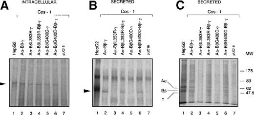 Fig. 3. Expression of wild-type and mutant fibrinogen chains in COS-1 cells. / Intracellular and secreted fibrinogen from COS-1 cells transfected with wild-type Aα and γ-chains together with wild-type and/or L353R or G400D Bβ, chains have been analyzed. Metabolic labeling, immunoprecipitation, and SDS-PAGE were carried out as described in “Materials and Methods.” (A) Immunoprecipitable proteins in cell lysates separated on 4% SDS-PAGE under nonreducing conditions. The arrowhead indicates the 340-kd fibrinogen complex. (B) Immunoprecipitable proteins in the culture media separated on 4% SDS-PAGE under nonreducing conditions. The arrowhead indicates the 340-kd fibrinogen complex. (C) Immunoprecipitable proteins in the culture media separated on 10% SDS-PAGE under reducing conditions. The positions of Aα, Bβ, and γ chains are indicated. The position of molecular weight markers (MW) in kd is denoted at the right-hand side of the figure.