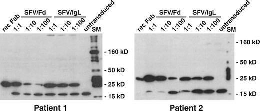 Fig. 3. Expression of recombinant idiotype in SFV-transduced DC. / Lymphoma-derived immunoglobulin genes were inserted with an attached hexahistidine tag into the SFV vector plasmid pSFV1. In vitro transcripts were synthesized from idiotype SFV vector plasmids, and the helper plasmid pSFVhelper1. BHK-21 packaging cells were electroporated with a mixture of helper and idiotype vector transcripts. Twenty-four hours later, infectious BHK-21 supernatants were harvested and used for transduction of terminally differentiated DC at 1:1, 1:10, and 1:100 dilutions. Twenty-four hours after transduction, DC were lysed and analyzed by Western blot with an antihistidine antibody. Bound antibody was detected by chemiluminescence. rec Fab, recombinant Fab fragment loaded as control; SFV/Fd, SFV/IgL, transduction with SFV vectors encoding the heavy- or light-chain idiotype of the respective patient's lymphoma; SM, 10- to 250-kd molecular weight marker.