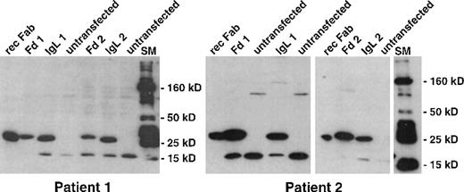 Fig. 4. Expression of recombinant idiotype in stably transfected LCL. / Lymphoma-derived immunoglobulin genes were inserted with an attached hexahistidine tag into the EBV-replicon vector pCEP4. Well-proliferating LCL were electroporated and selected with hygromycin. Hygromycin-resistant LCL were lysed and analyzed by Western blot with an antihistidine antibody. Bound antibody was detected by chemiluminescence. rec Fab, recombinant Fab fragment loaded as control; Fd1, IgL1, LCL transfected with pCEP4 vectors encoding the heavy- and light-chain idiotype gene of patient 1; Fd2, IgL2, LCL transfected with pCEP4 vectors encoding the heavy- and light-chain idiotype gene of patient 2; SM, 10- to 250-kd molecular weight marker.